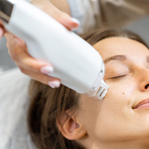 ピコフラクショナル