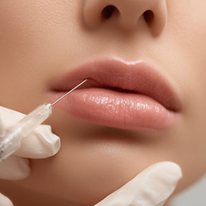 ヒアルロン酸注射