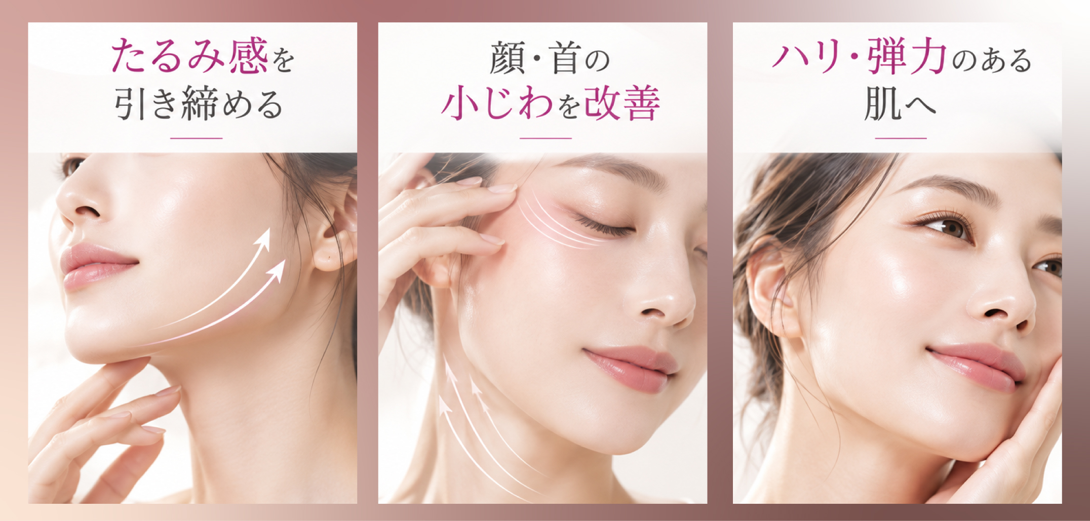 ソフウェーブ（Sofwave）の効果
